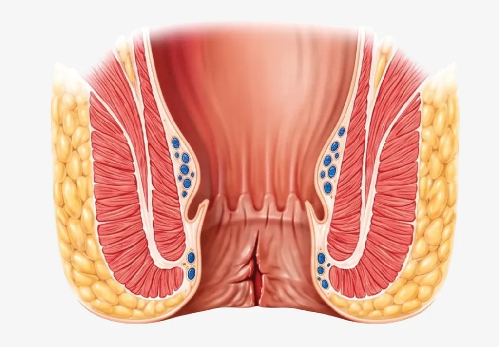 Best Fissure Treatment in Ahmedabad